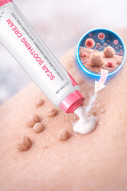 Scar free wart removal cream