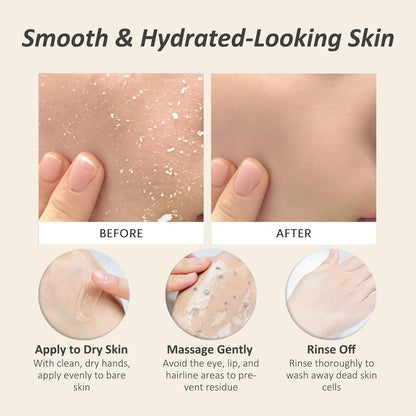 Derma exfoliating cream